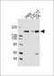 (Mouse) Smarcc1 Antibody (C-term)